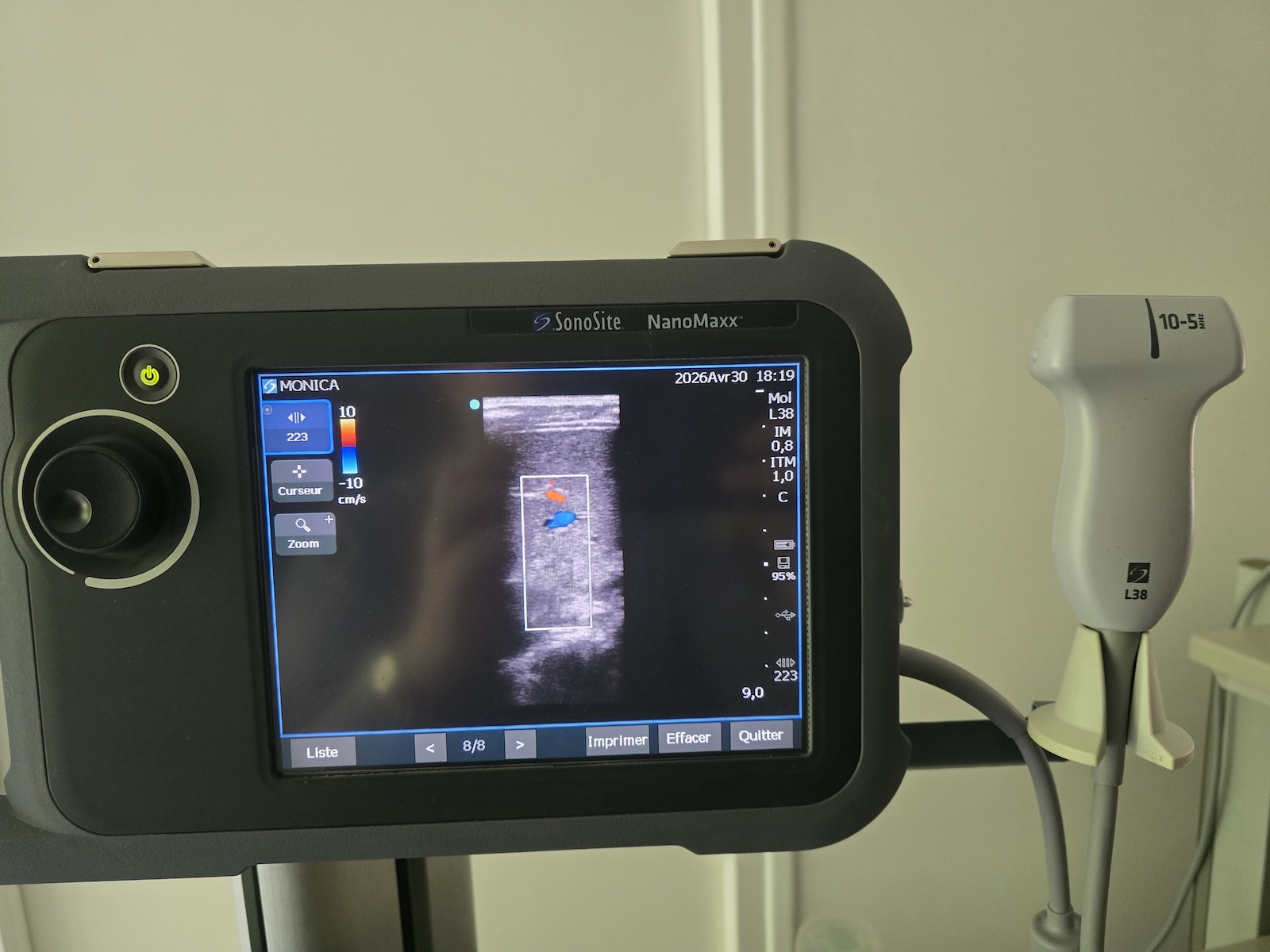 Image(s) de l'annonce Échographe SonoSite NanoMaxx + sonde L38 + Doppler couleur – idéal kiné / sport / MSK
