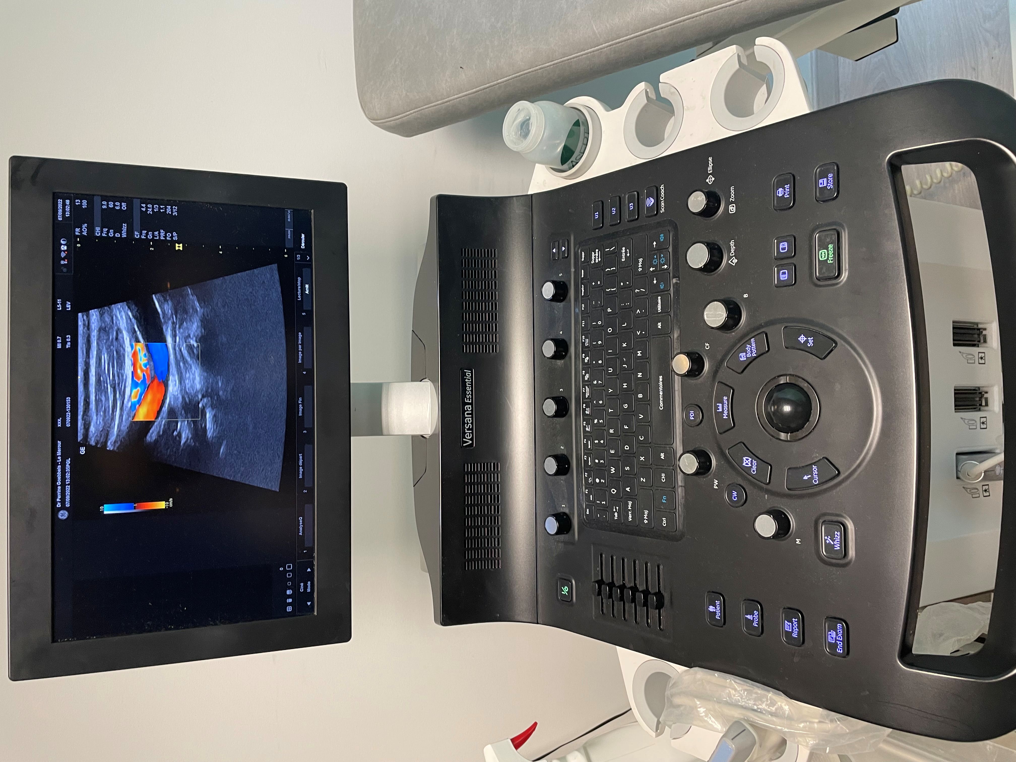 Image(s) de l'annonce 34 VD APPAREIL ECHODOPPLER COULEUR VERSANA ESSENTIEL DE GENERAL ELECTRIC