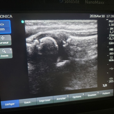 Image(s) de l'annonce Échographe SonoSite NanoMaxx + sonde L38 + Doppler couleur – idéal kiné / sport / MSK