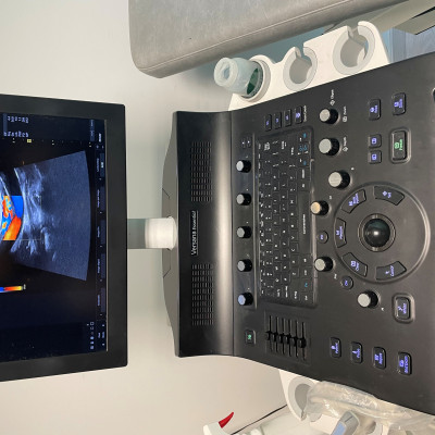 Image(s) de l'annonce 34 VD APPAREIL ECHODOPPLER COULEUR VERSANA ESSENTIEL DE GENERAL ELECTRIC