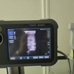 Échographe SonoSite NanoMaxx + sonde L38 + Doppler couleur – idéal kiné / sport / MSK