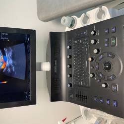 34 VD APPAREIL ECHODOPPLER COULEUR VERSANA ESSENTIEL DE GENERAL ELECTRIC